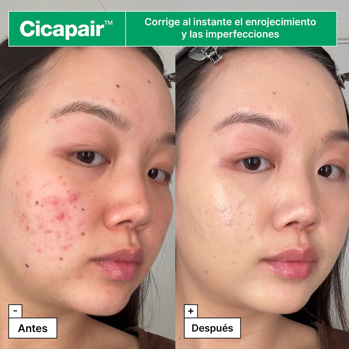 CICAPAIR™ SOOTHING COLOR CORRECTING TREATMENT SPF 30 WITH CENTELLA ASIATICA EXTRACTS (TRATAMIENTO CALMANTE CON COLOR)